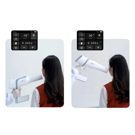 Woodpecker - Ai Ray Portable Dental X - Ray Device