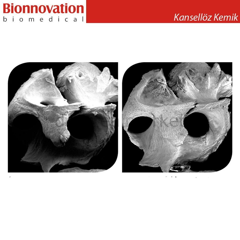 Bionnovation - Bonefill Prous (Cancellous) Bovine Graft - Xenograft - 0,5gr (0.75 cc)