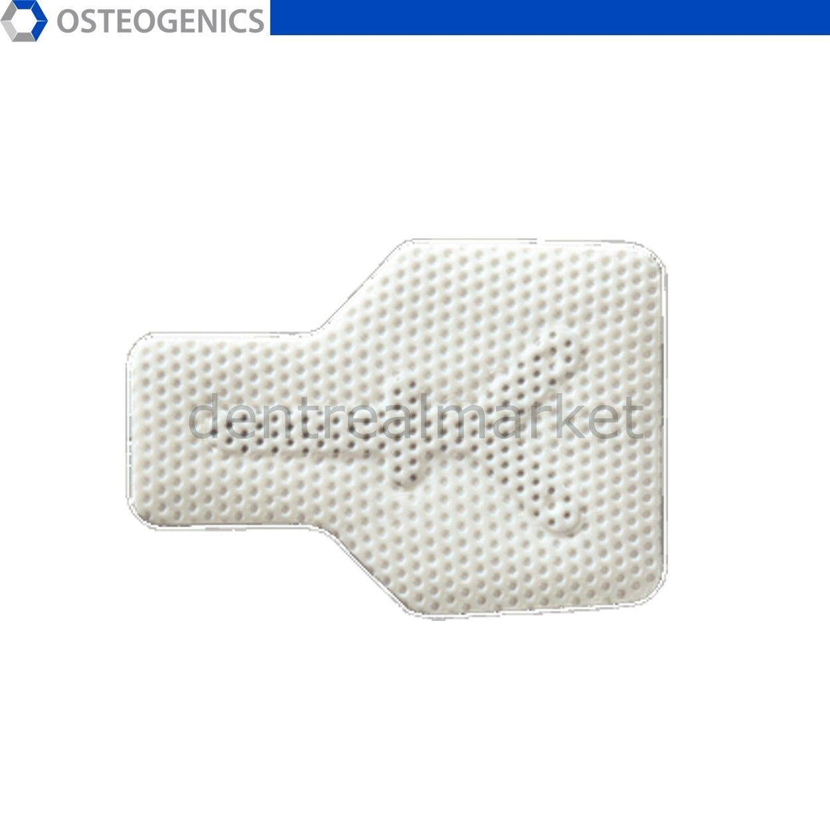 Osteogenics - Cytoplast Titanium High - Density PTFE Membranes - Buccal 17*25 mm