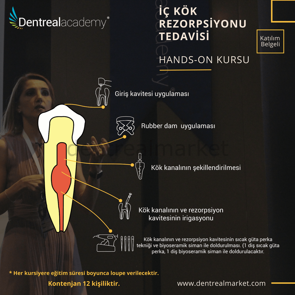 Dentrealacademy - Inner Root Resorption Treatment Hands - On Course