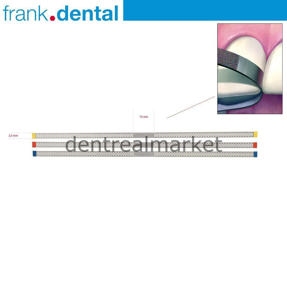 Frank Dental - Interface Sander with Interproximal Holes 2.5 mm