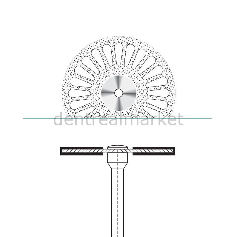 Frank Dental - Ortho Diamond Disc Interface Separe - Double Sided Etching