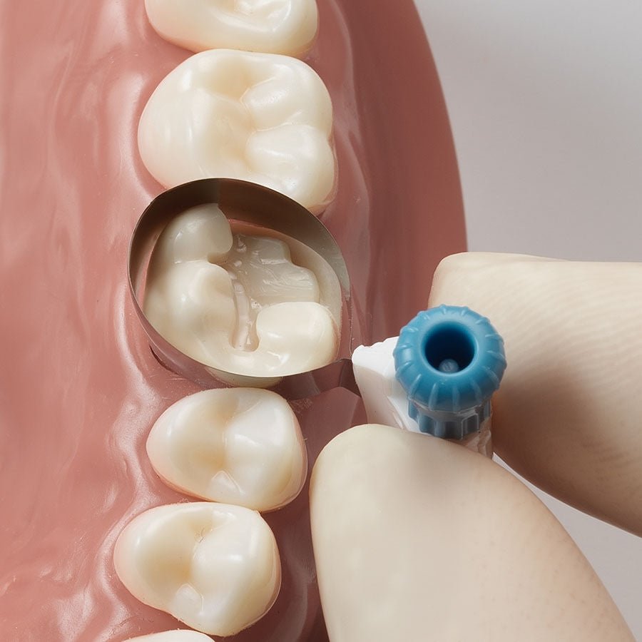 Dentsply - Sirona - Palodent 360 Circumferential Matrix System Kit