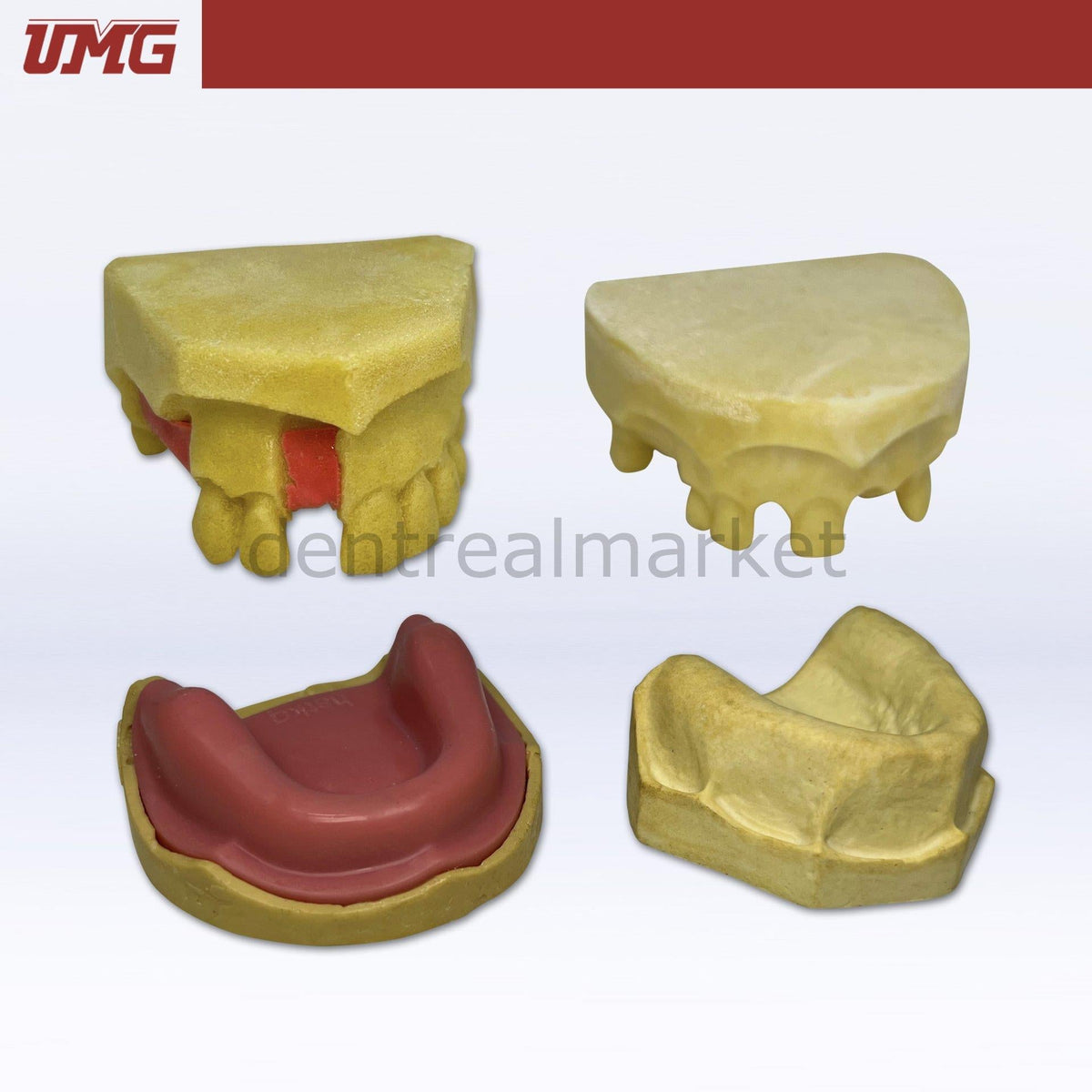 Umg Dental - Umg Model Implant Training Model - UM - H7