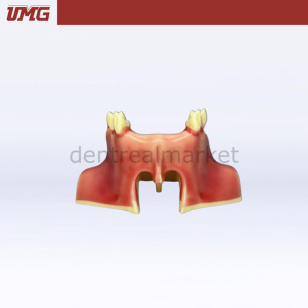 Umg Dental - Umg Model Sine Lift Training Model - UM - 2012