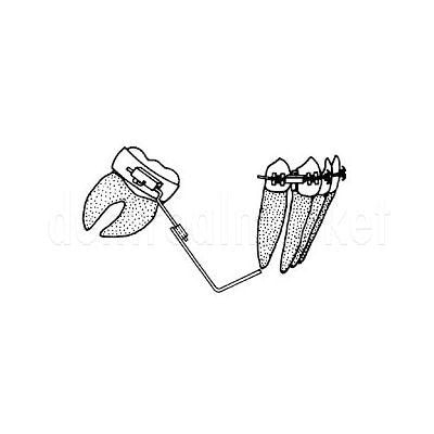 DentrealStore - Dynaflex Molar Uprighting Springs